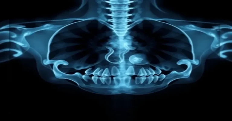 The 7 Best Dye Xray Options of 2026